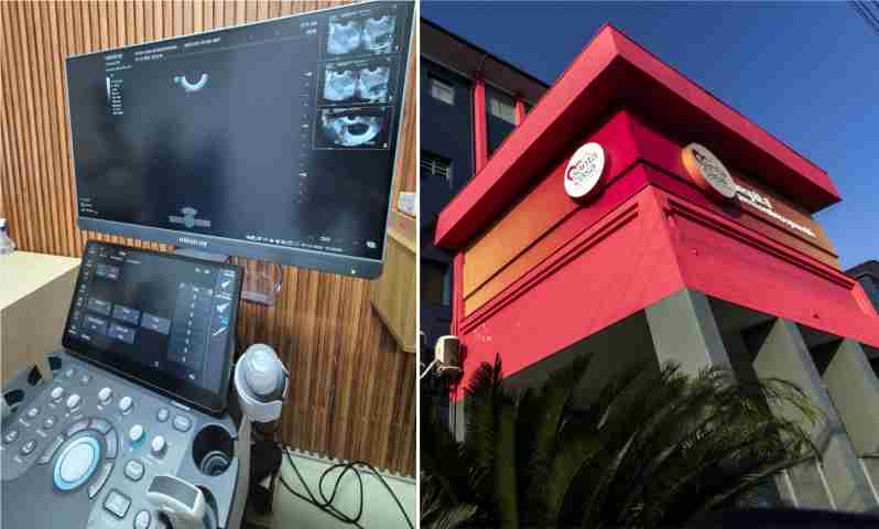 Inteligência Artificial agiliza exames de ultrassom na Santa Casa de Mogi